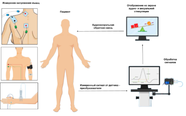 Электромиографическая БОС